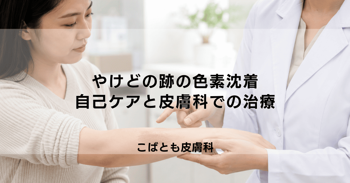やけどの跡の色素沈着を薄くする方法|自分でできるケアと皮膚科での治療法