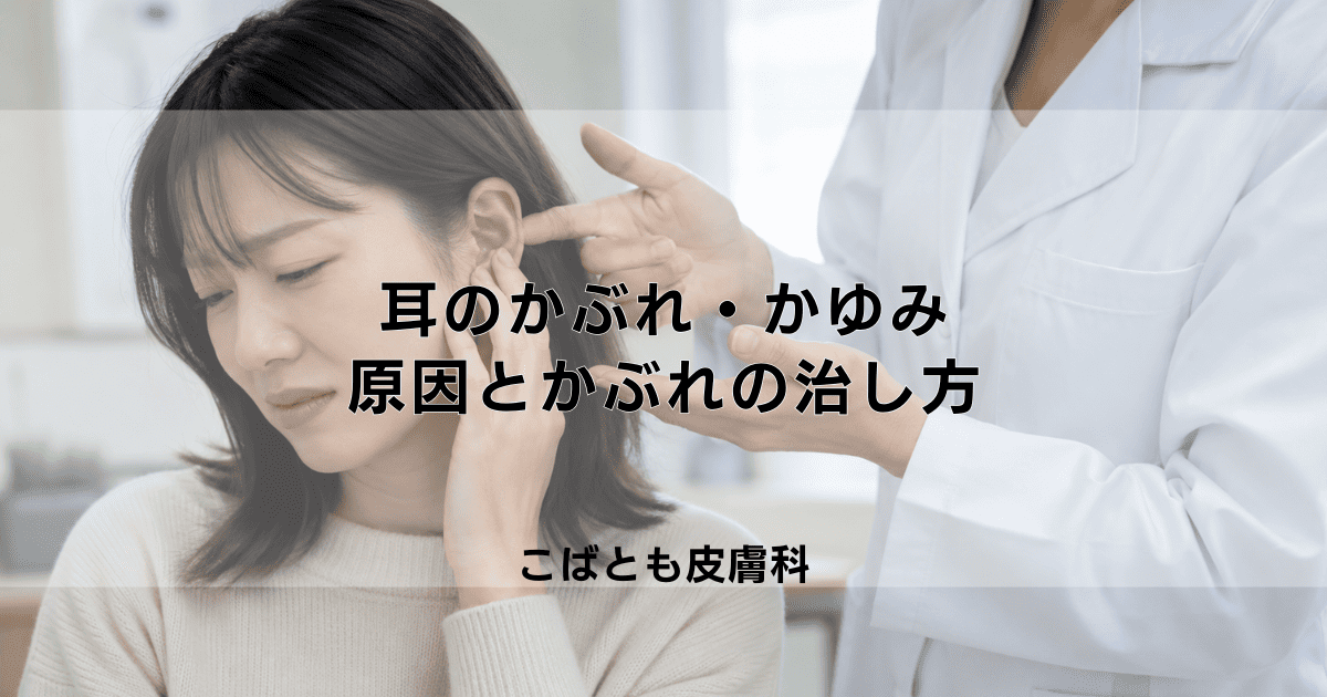 耳のかぶれ・かゆみの原因は？ピアスやイヤホン、シャンプーかぶれの治し方