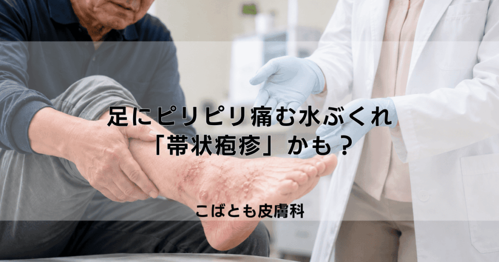 足にピリピリ痛む水ぶくれが…それ「帯状疱疹」かも？初期症状と治療法