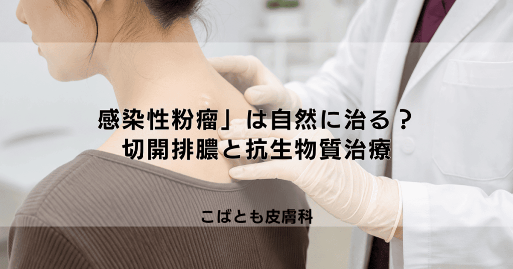 痛い「感染性粉瘤」は自然に治る？病院での切開排膿と抗生物質による治療