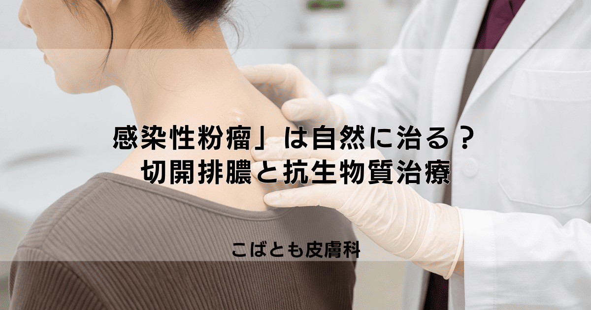 痛い「感染性粉瘤」は自然に治る？病院での切開排膿と抗生物質による治療