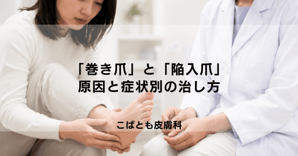「巻き爪」と「陥入爪」の違いは？痛みの原因と症状別の正しい治し方