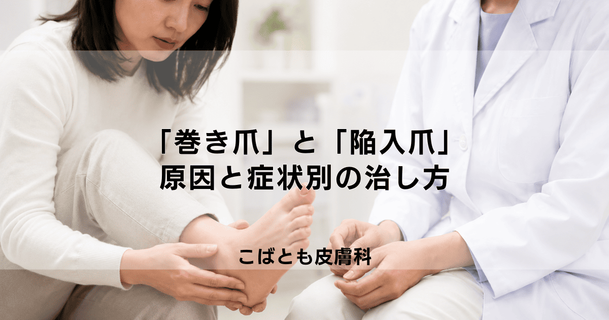 「巻き爪」と「陥入爪」の違いは？痛みの原因と症状別の正しい治し方