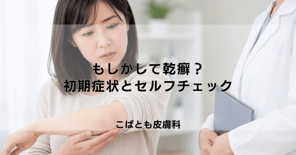 もしかして乾癬？知っておきたい初期症状とセルフチェックのポイント