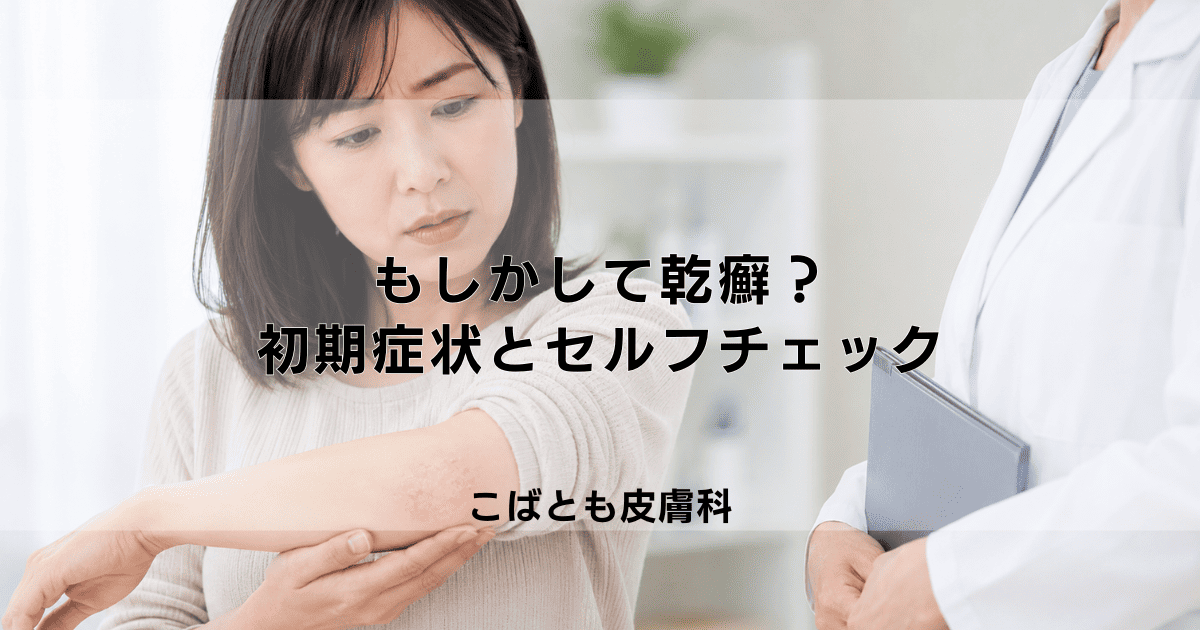 もしかして乾癬？知っておきたい初期症状とセルフチェックのポイント