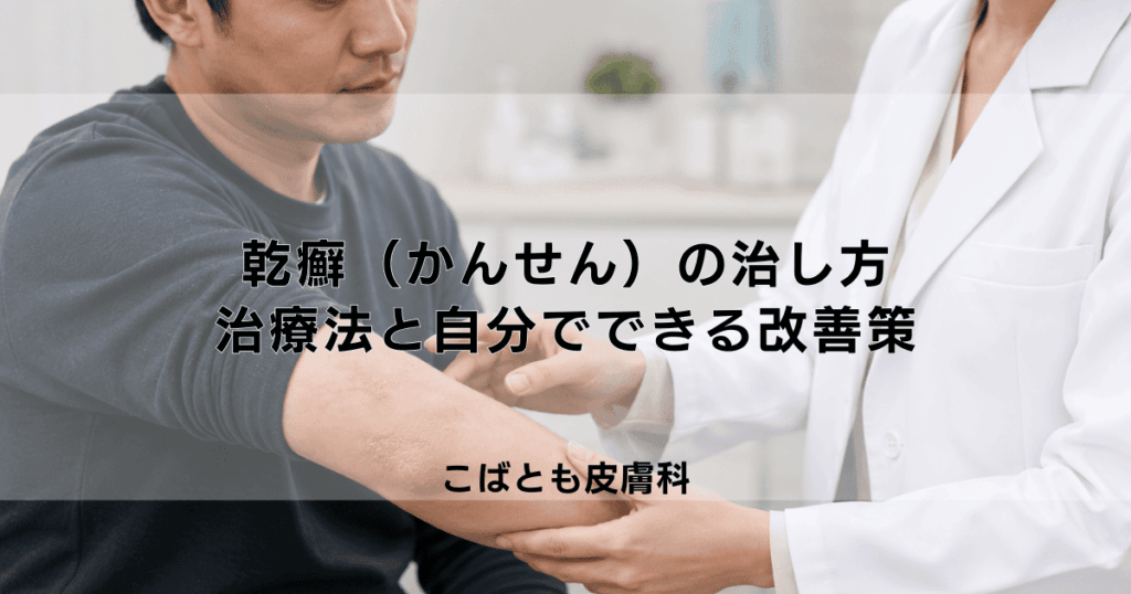 乾癬（かんせん）の治し方｜皮膚科での治療法の種類と自分でできる改善策