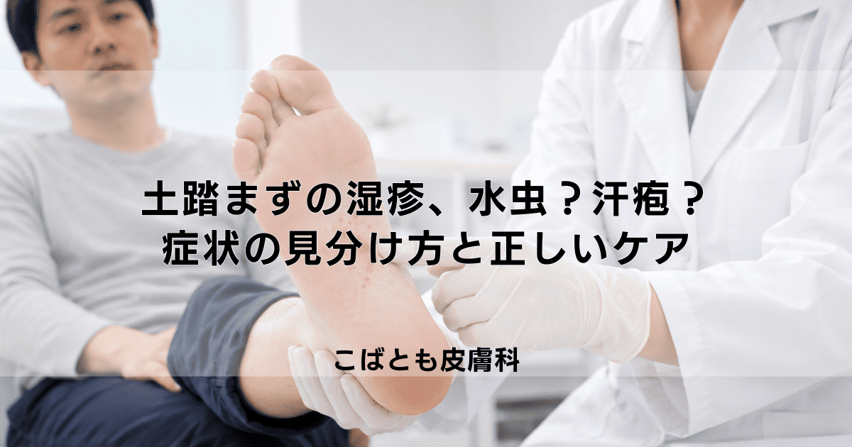 土踏まずの湿疹、それ水虫?汗疱(かんぽう)?症状の見分け方と正しいケア