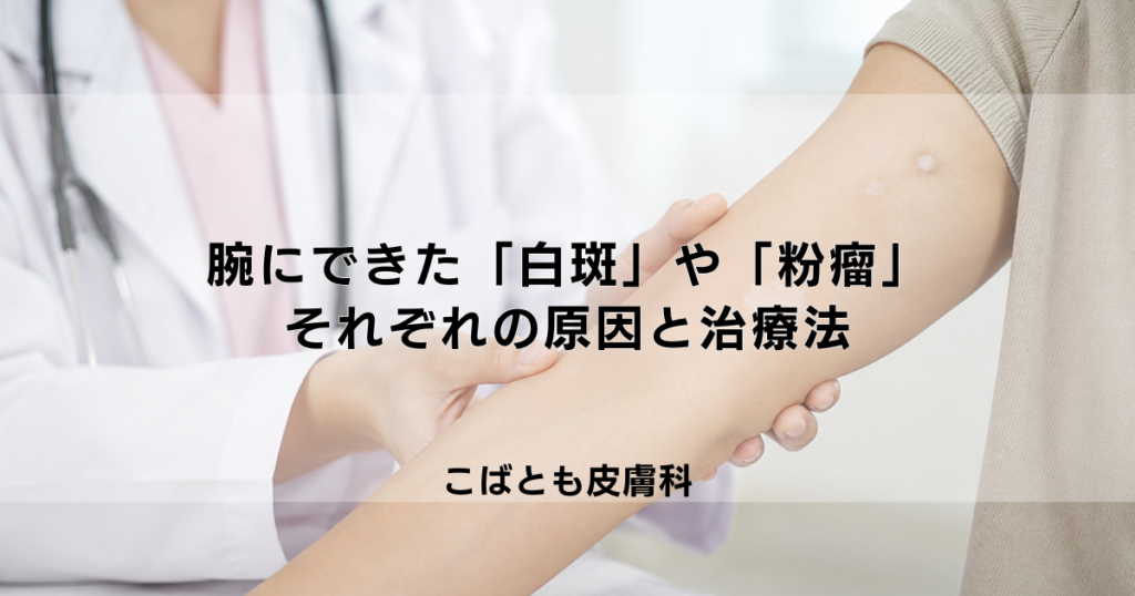 腕にできた白い斑点「白斑」や「粉瘤」のしこり、それぞれの原因と治療法