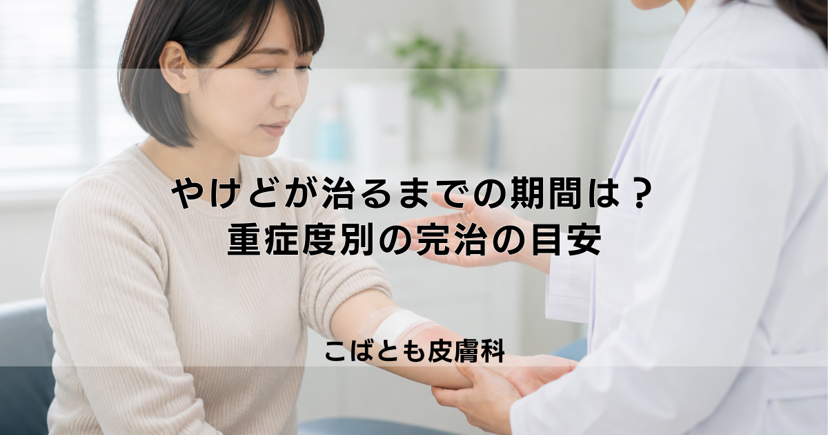 やけどが治るまでの期間は？重症度（1度・2度）別の完治の目安を解説