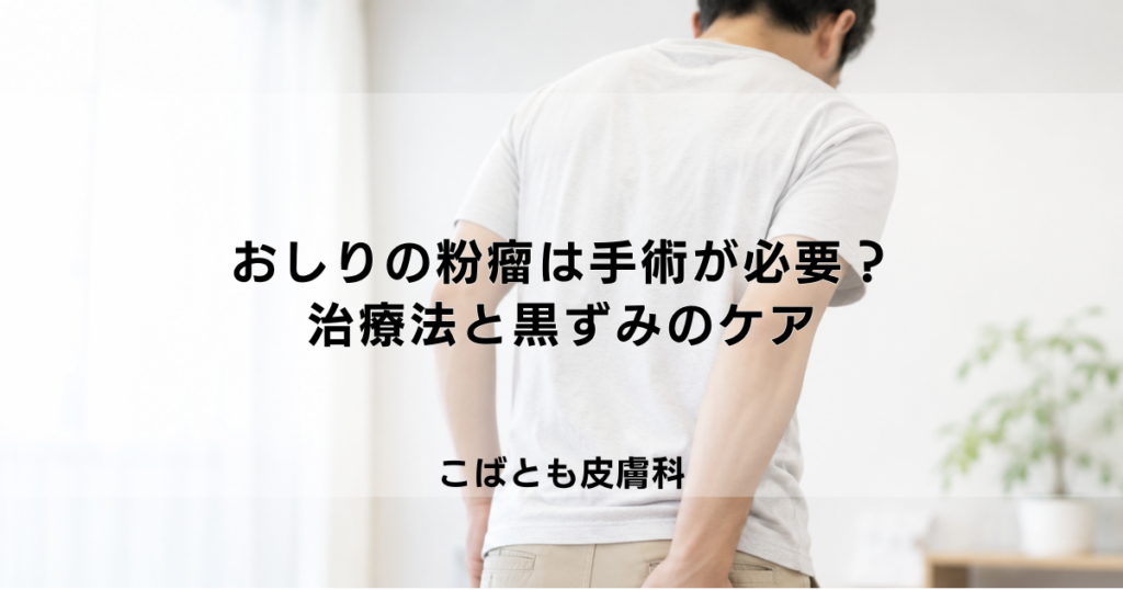 おしりの粉瘤（ふんりゅう）は手術が必要？薬での治療法と気になる黒ずみのケア