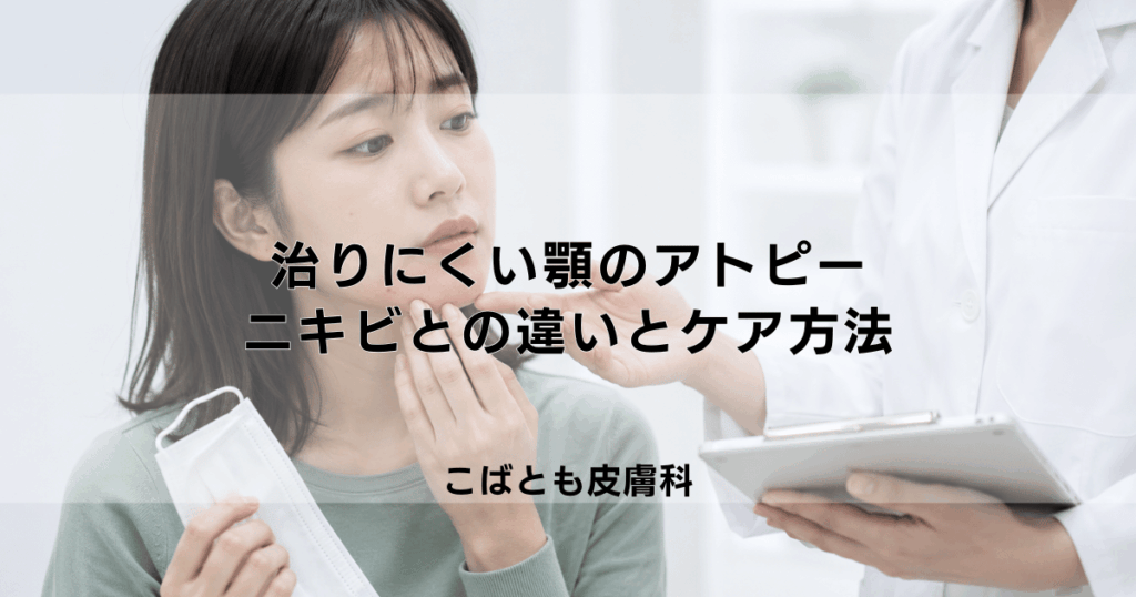 治りにくい顎のアトピー、原因はマスクのせい？ニキビとの違いと正しいケア方法