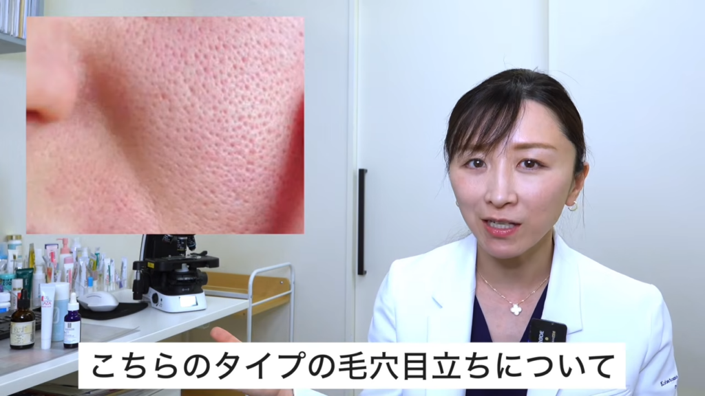 毛穴目立ち
