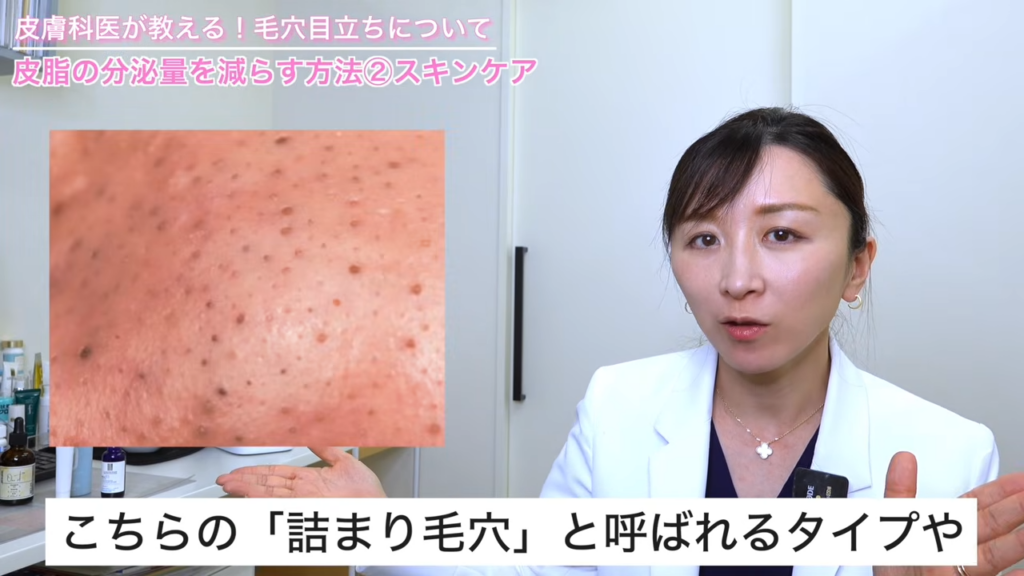 詰まり毛穴