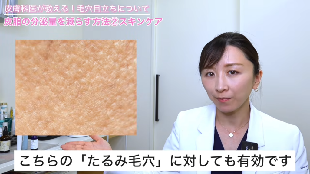 たるみ毛穴