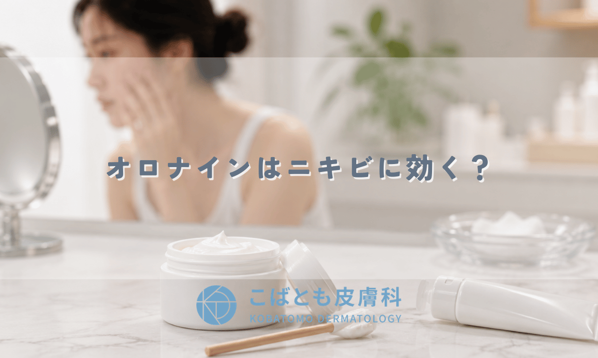 オロナインはニキビに効く？効果がある場合・ない場合と正しい使い方