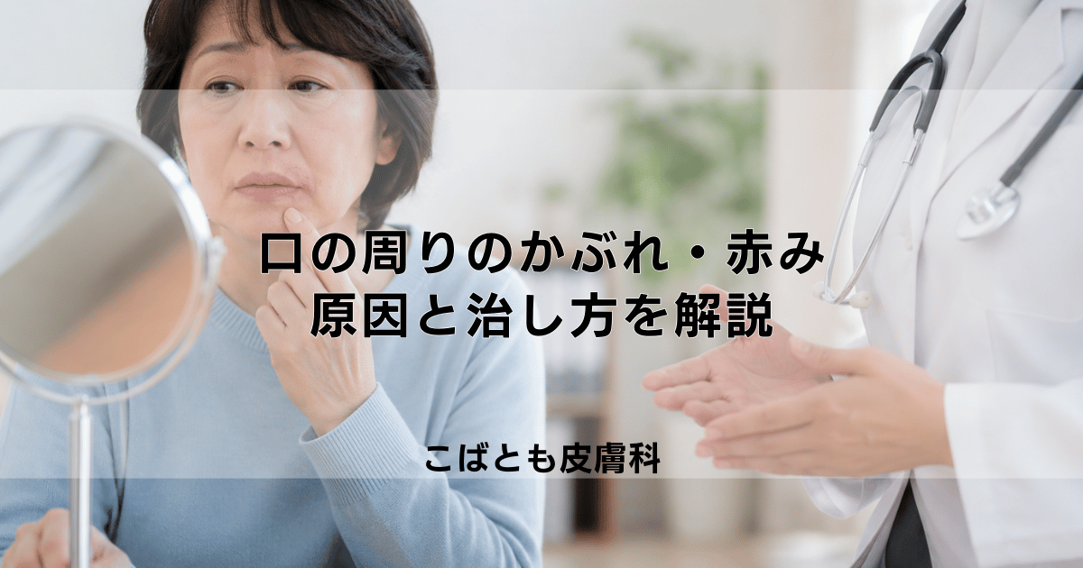 口の周りのかぶれ・赤みの原因は？リップクリームや食べ物？治し方を解説