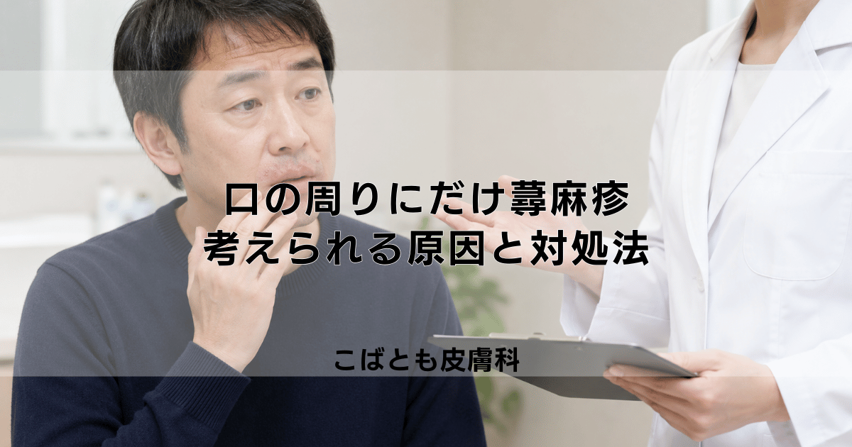 口の周りにだけ蕁麻疹が…食べ物アレルギー？考えられる原因と対処法