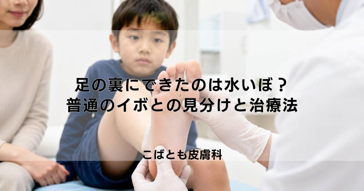 足の裏にできたのは水いぼ？普通のイボとの見分け方と治療法