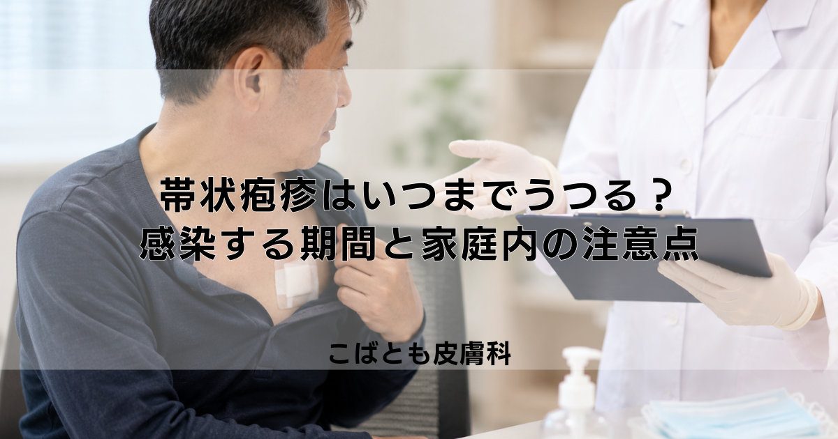 帯状疱疹はいつまでうつる？感染力がある期間と家庭内での注意点
