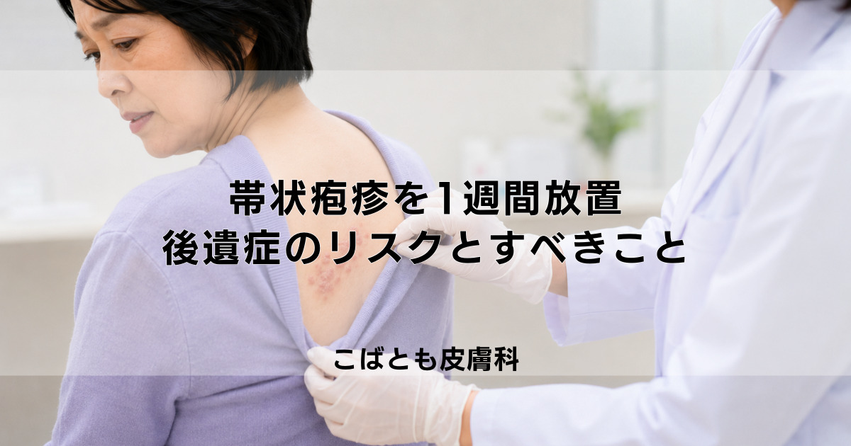 帯状疱疹を1週間放置してしまったら…後遺症のリスクと今からでもすべきこと