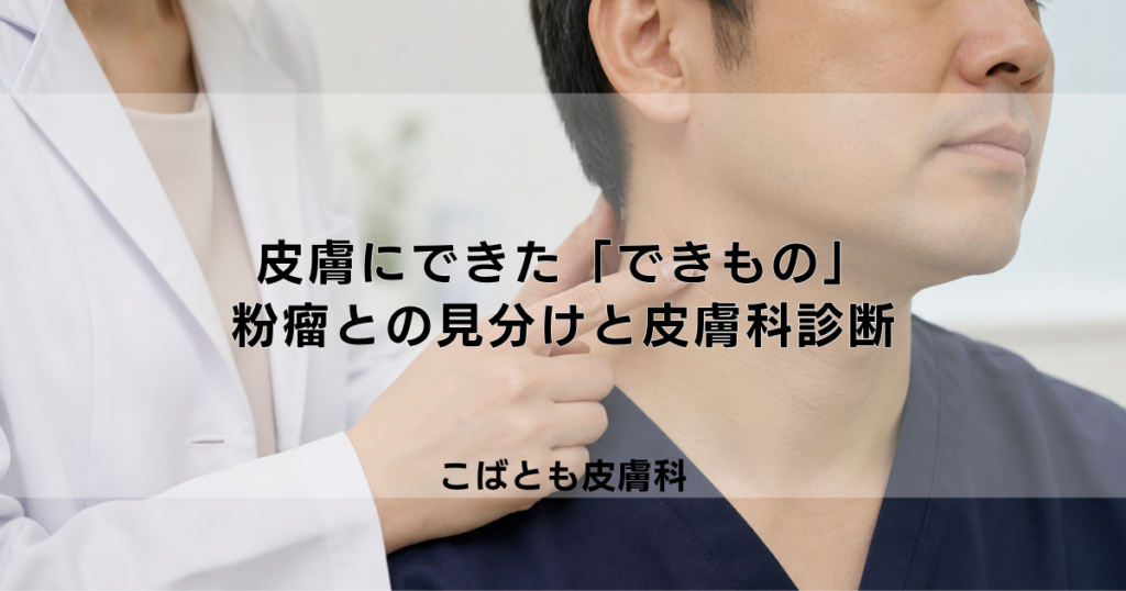皮膚にできた「できもの」の正体は？粉瘤（ふんりゅう）との見分け方と皮膚科での診断