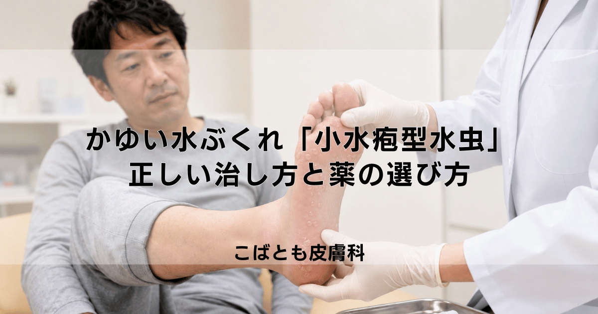 かゆい水ぶくれができる「小水疱型水虫」の正しい治し方と薬の選び方
