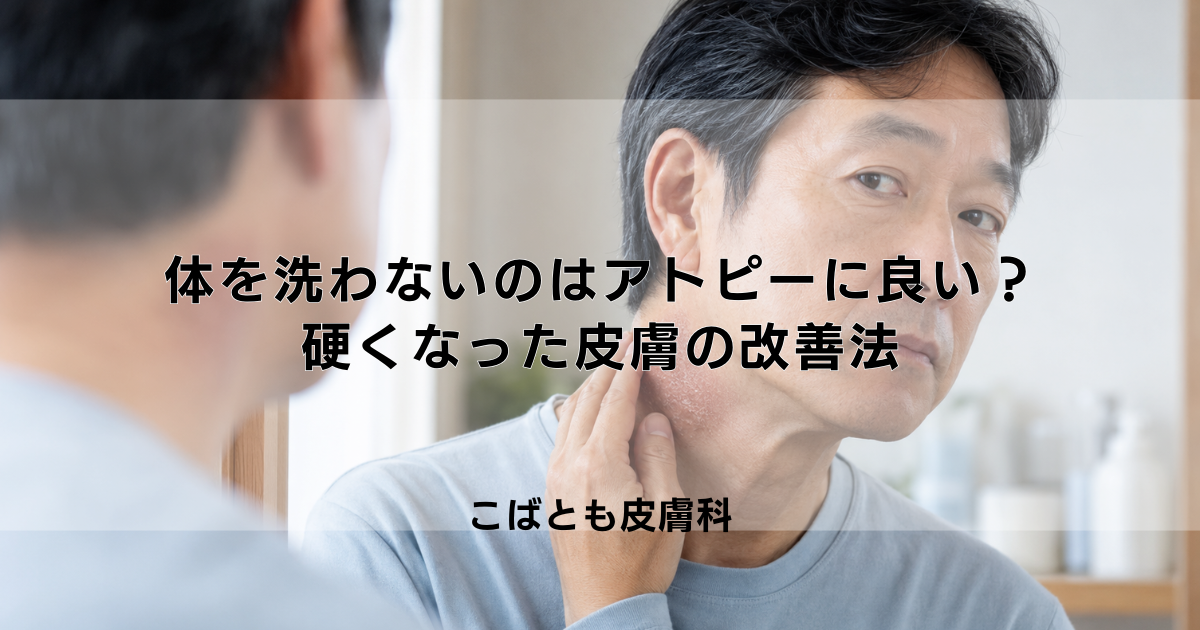「体を洗わない」はアトピーに良い?苔癬化して硬くなった皮膚の改善法