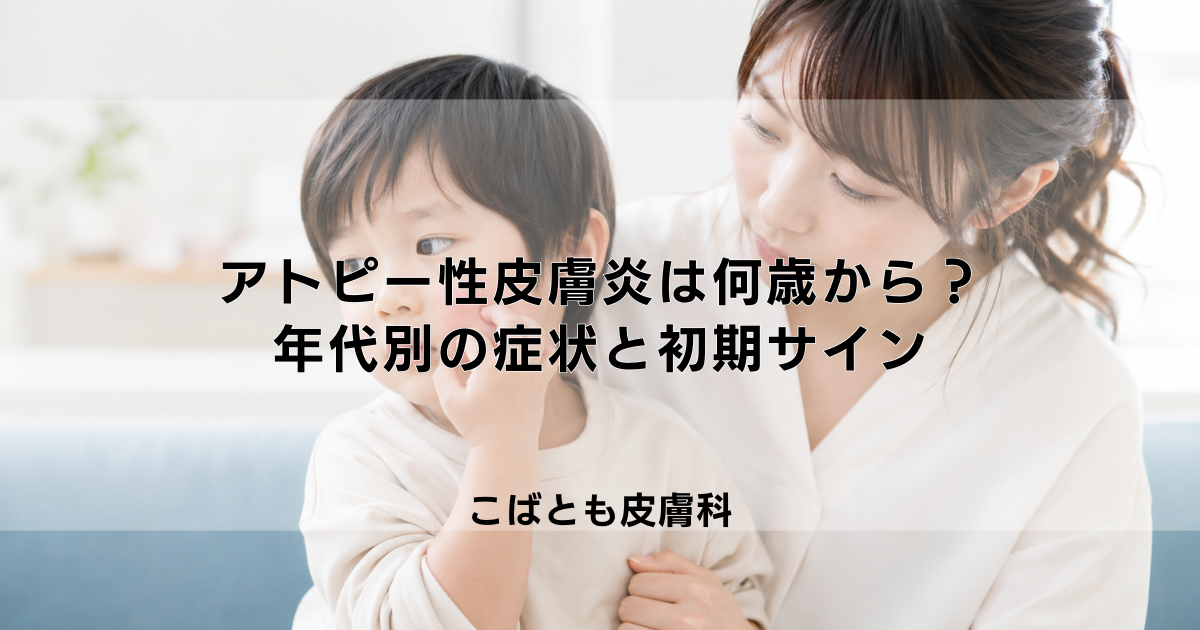 アトピー性皮膚炎は何歳から発症する?年代別の症状の特徴と初期サイン