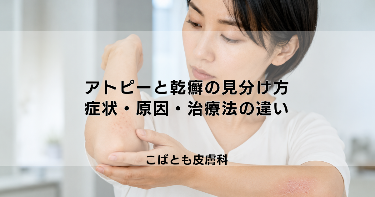 アトピーと乾癬（かんせん）の見分け方｜症状・原因・治療法の違いを解説