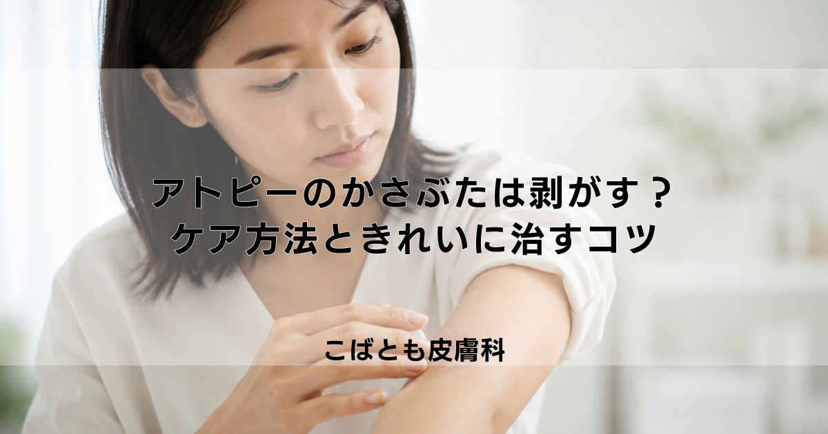 アトピーのかさぶたは剥がすべき？正しいケア方法と早くきれいに治すコツ