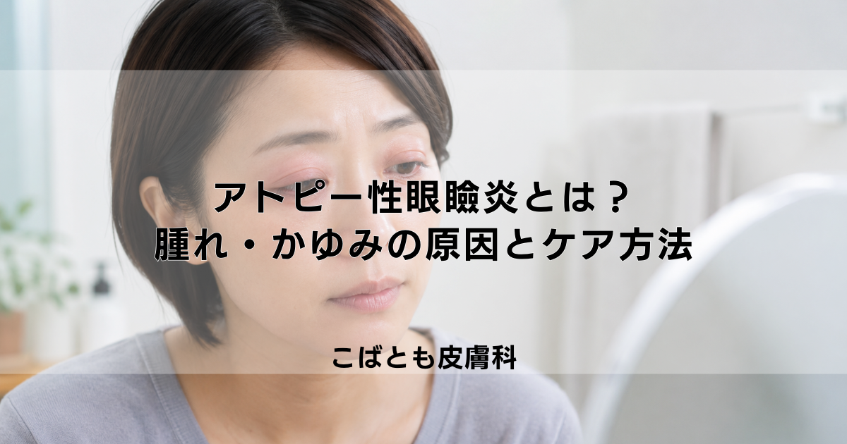 アトピー性眼瞼炎とは？まぶたの腫れ・かゆみの原因と正しいケア方法