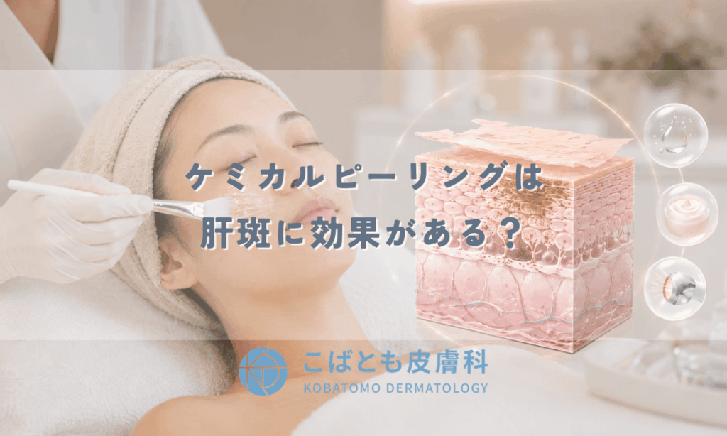 ケミカルピーリングは肝斑に効果がある？単独では不十分な理由と併用治療を皮膚科医が解説