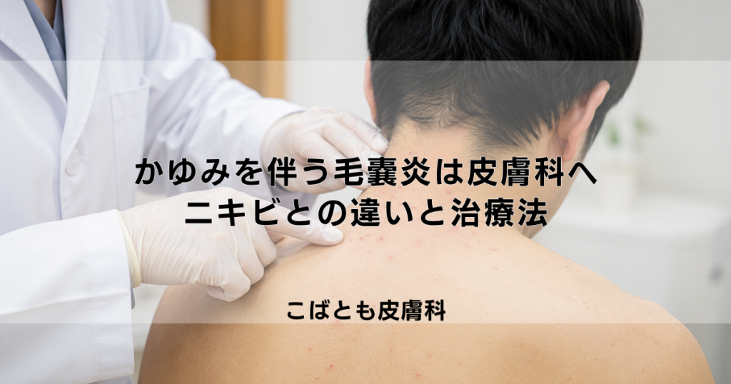 かゆみを伴う「毛嚢炎（もうのうえん）」は皮膚科へ｜ニキビとの違いと治療法