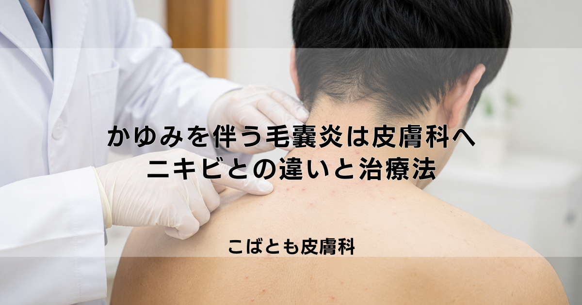 かゆみを伴う「毛嚢炎（もうのうえん）」は皮膚科へ｜ニキビとの違いと治療法