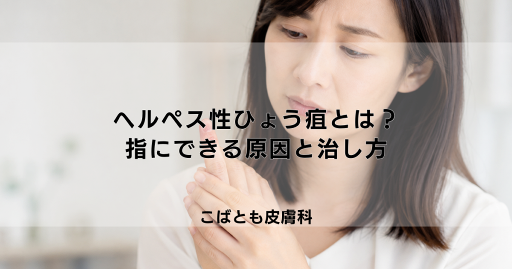 ヘルペス性ひょう疽とは？指にできるヘルペスの感染原因と正しい治し