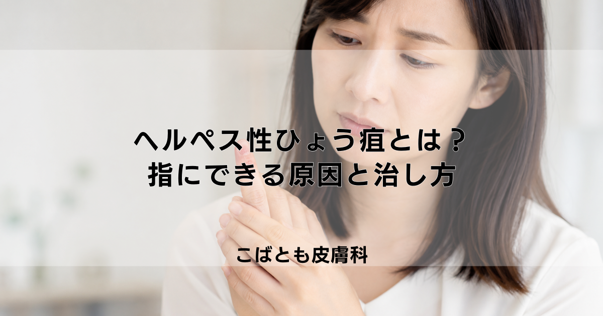 ヘルペス性ひょう疽とは？指にできるヘルペスの感染原因と正しい治し