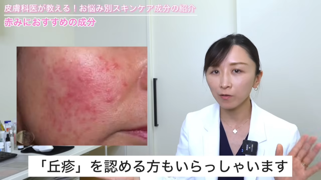丘疹の症状写真