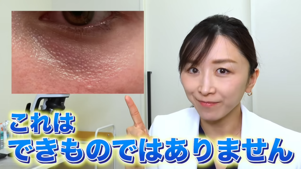 目の下のブツブツ 症例写真