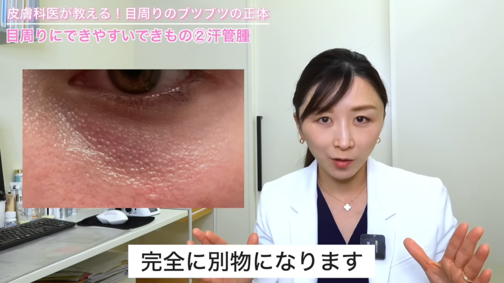 目の下のブツブツ 症例写真