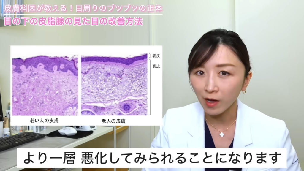 若い人の皮膚・老人の皮膚 比較図