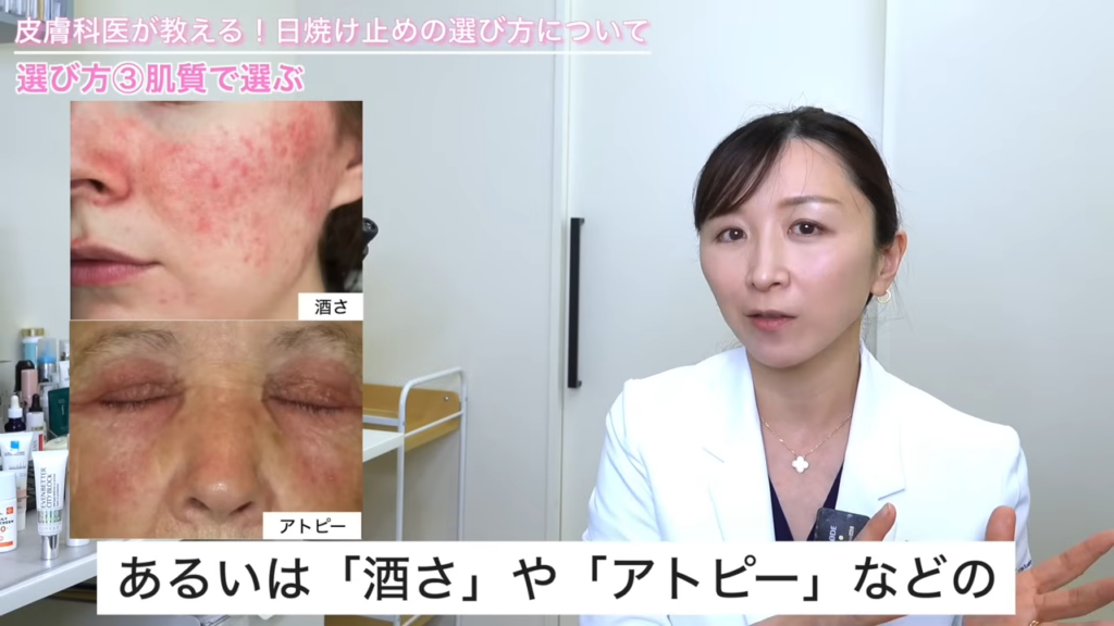酒さ・アトピーの症状写真