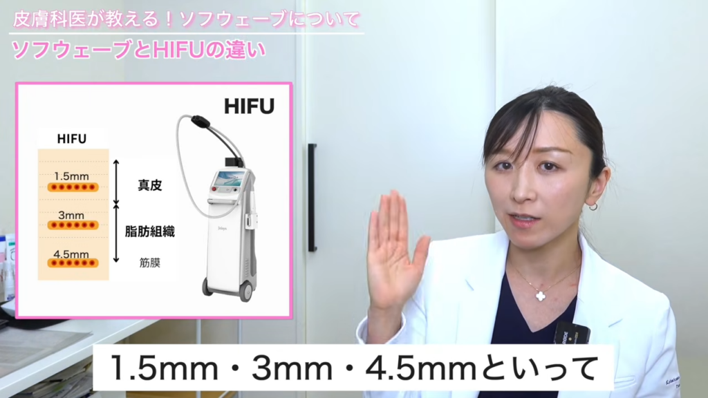 HIFUの特徴