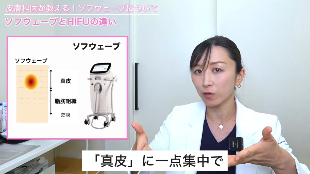 ソフウェーブの特徴