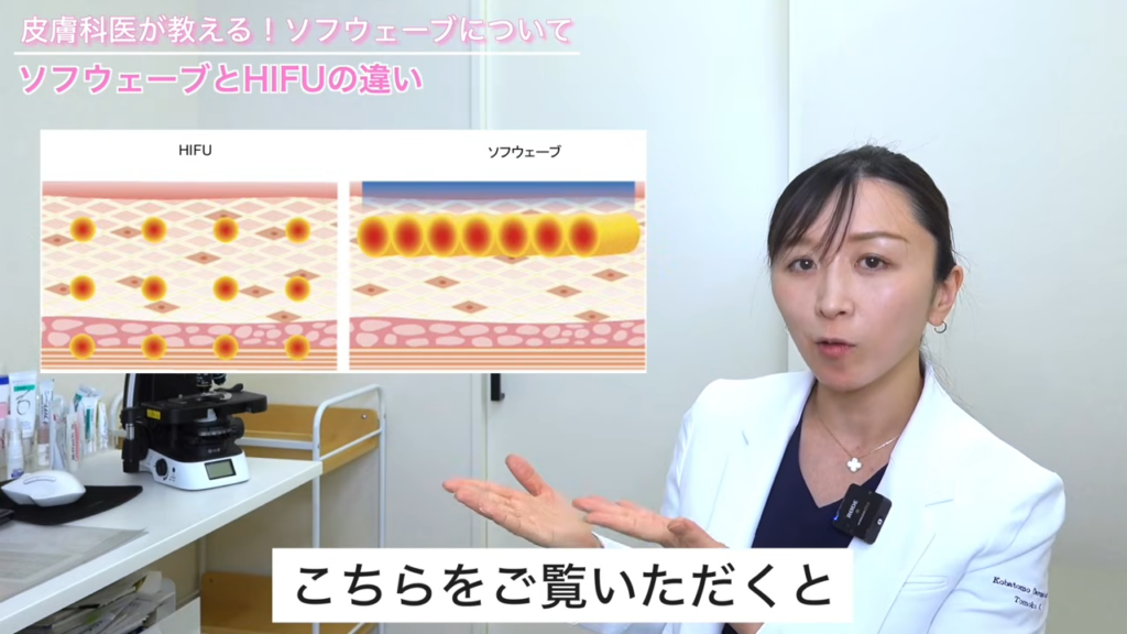 ハイフとソフウェーブの熱量の違い