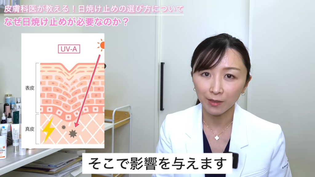 UVAの解説図