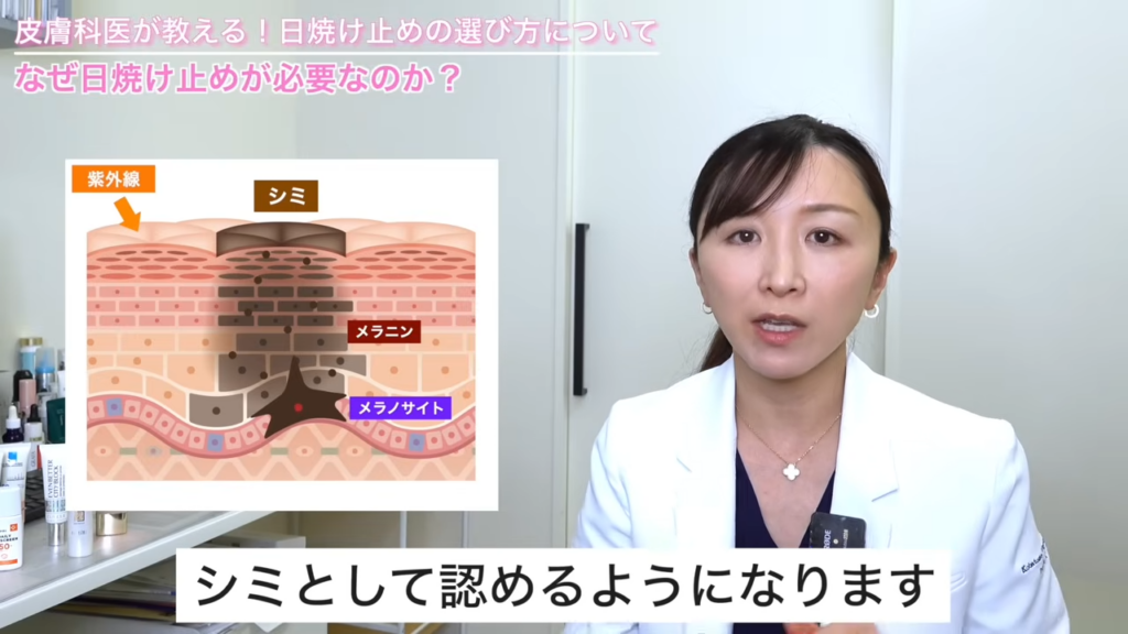シミがつくられる仕組み