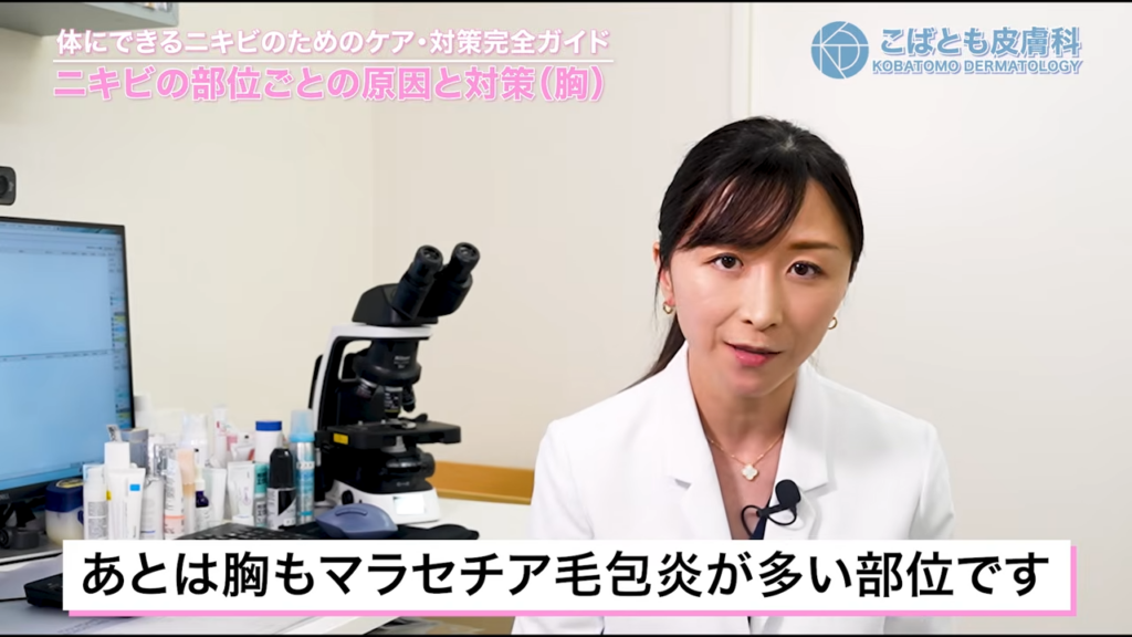 胸もマラセチア毛包炎が多い部位