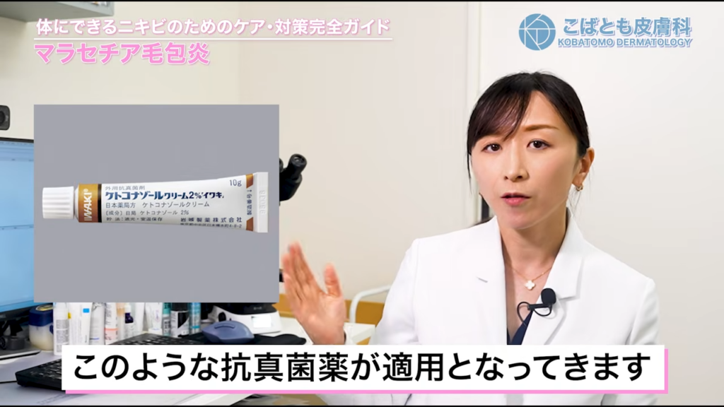 マラセチア毛包炎に適用となる抗真菌薬