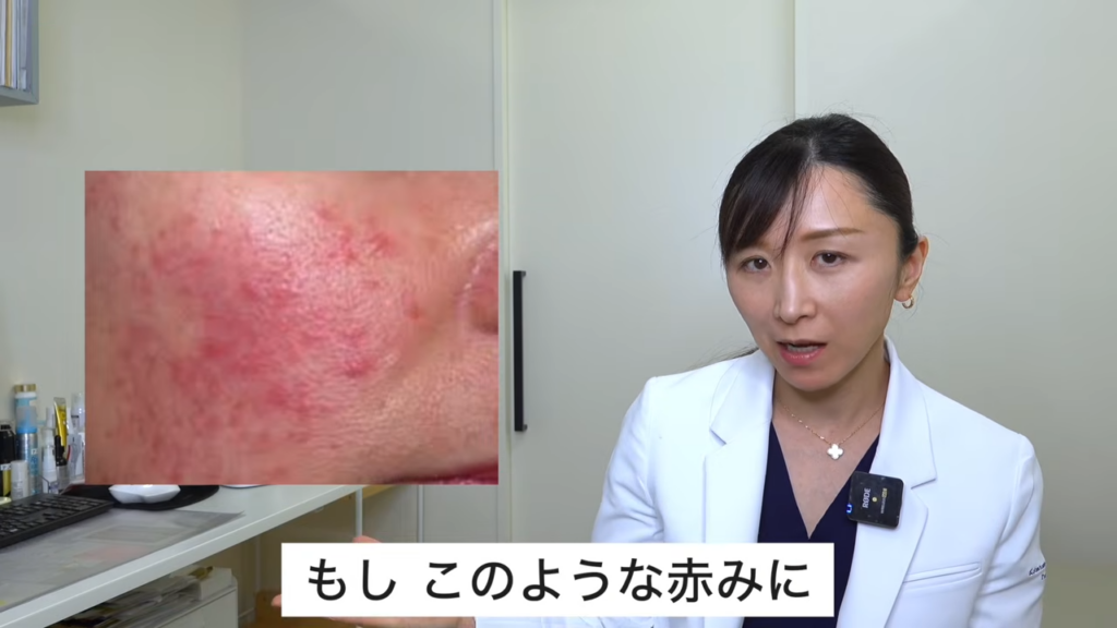 肌の赤み 症状写真