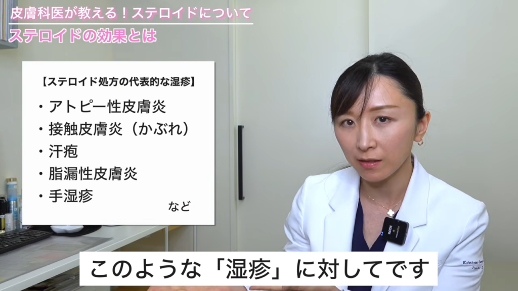ステロイド処方の代表的な湿疹→アトピー性皮膚炎、接触皮膚炎(かぶれ)、汗疱、脂漏性皮膚炎、手湿疹など